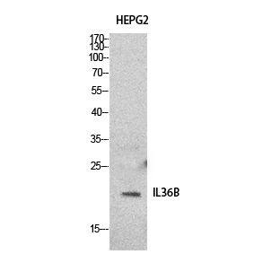Western blot analysis of IL-36 beta in HepG2 lysates using IL-36 beta antibody.