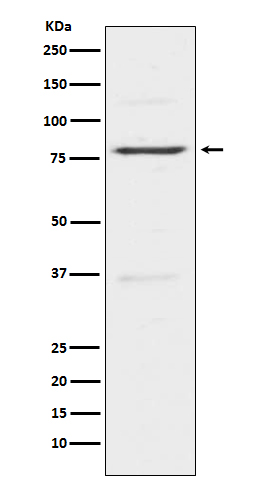 Western blot analysis of Insulin Receptor R in Hela lysates using Insulin Receptor Related Protein antibody.