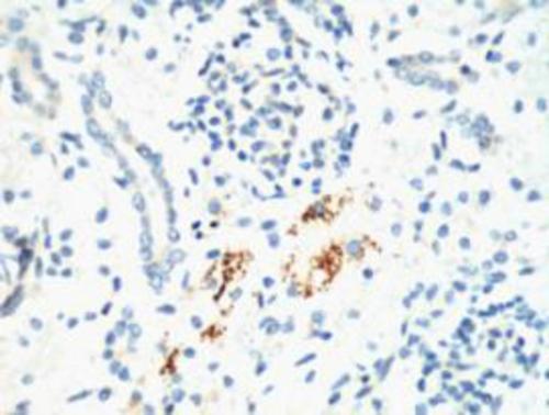 Immunohistochemistry analysis of paraffin-embedded mouse Kidney tissue using KIF7 (2A7) antibody.High-pressure and temperature Sodium Citrate pH 6.0 was used for antigen retrieval.