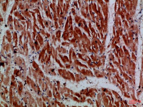 Immunohistochemistry analysis of paraffin-embedded Human heart using MYH6/7 antibody.High-pressure and temperature Sodium Citrate pH 6.0 was used for antigen retrieval.