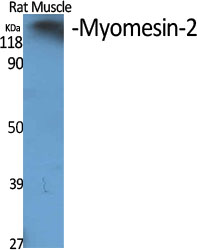 Western blot analysis of Myomesin 2 in various lysates using Myomesin 2 antibody.