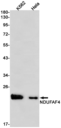 Western blot analysis of NDUFAF4 in K562, Hela lysates using NDUFAF4 antibody.