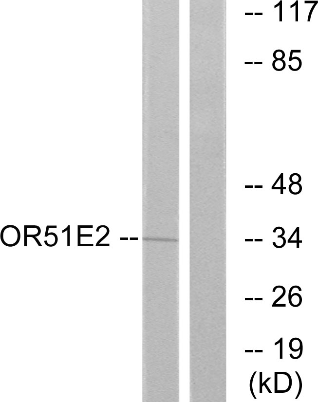 Western blot analysis of PSGR in Jurkat lysates using PSGR antibody.The lane on the right is blocked with the synthesized peptide.
