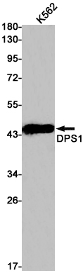 Western blot analysis of DPS1 in K562 lysates using DPS1 antibody.
