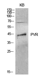 Western blot analysis of CD155 in KB lysates using CD155 antibody.
