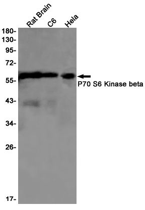Western blot analysis of P70 S6 Kinase beta in rat Brain, C6, Hela lysates using P70 S6 Kinase beta antibody.