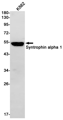 Western blot analysis of Syntrophin alpha 1 in K562 lysates using Syntrophin alpha 1 antibody
