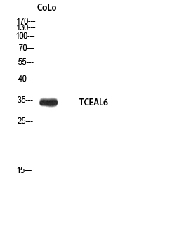 Western blot analysis of TCEAL6 in CoLo lysates using TCEAL6 antibody.