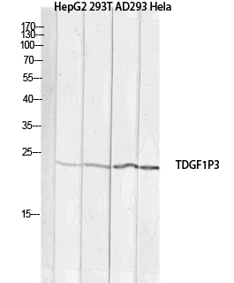 Western blot analysis of Cripto 3 in HepG2, 293T , AD293 , Hela lysates using Cripto 3 antibody.