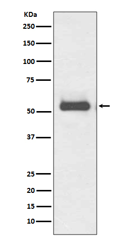 Western blot analysis of TRK fused gene in HeLa lysates using TFG antibody.