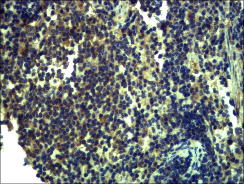 Immunohistochemistry analysis of paraffin-embedded mouse Spleen Tissue using Toll-Like Receptor 13 antibody.High-pressure and temperature Sodium Citrate pH 6.0 was used for antigen retrieval.
