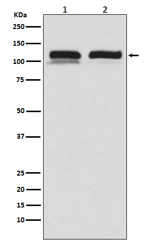 Western blot analysis of USP11 in (1) HEK293 lysates; (2) mouse testis lysates using USP11 antibody.