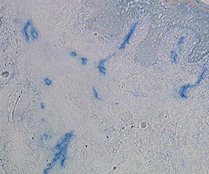 IHC staining of human skin frozen section with clone 117E10 (DX0351)