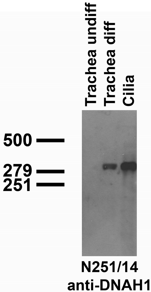 Cell immunoblot: extracts of undifferentiated and differentiated tracheal cells and of purified cilia and probed with N251/14 TC supe. Cell samples courtesy of Larry Ostrowski (University of North Carolina at Chapel Hill).