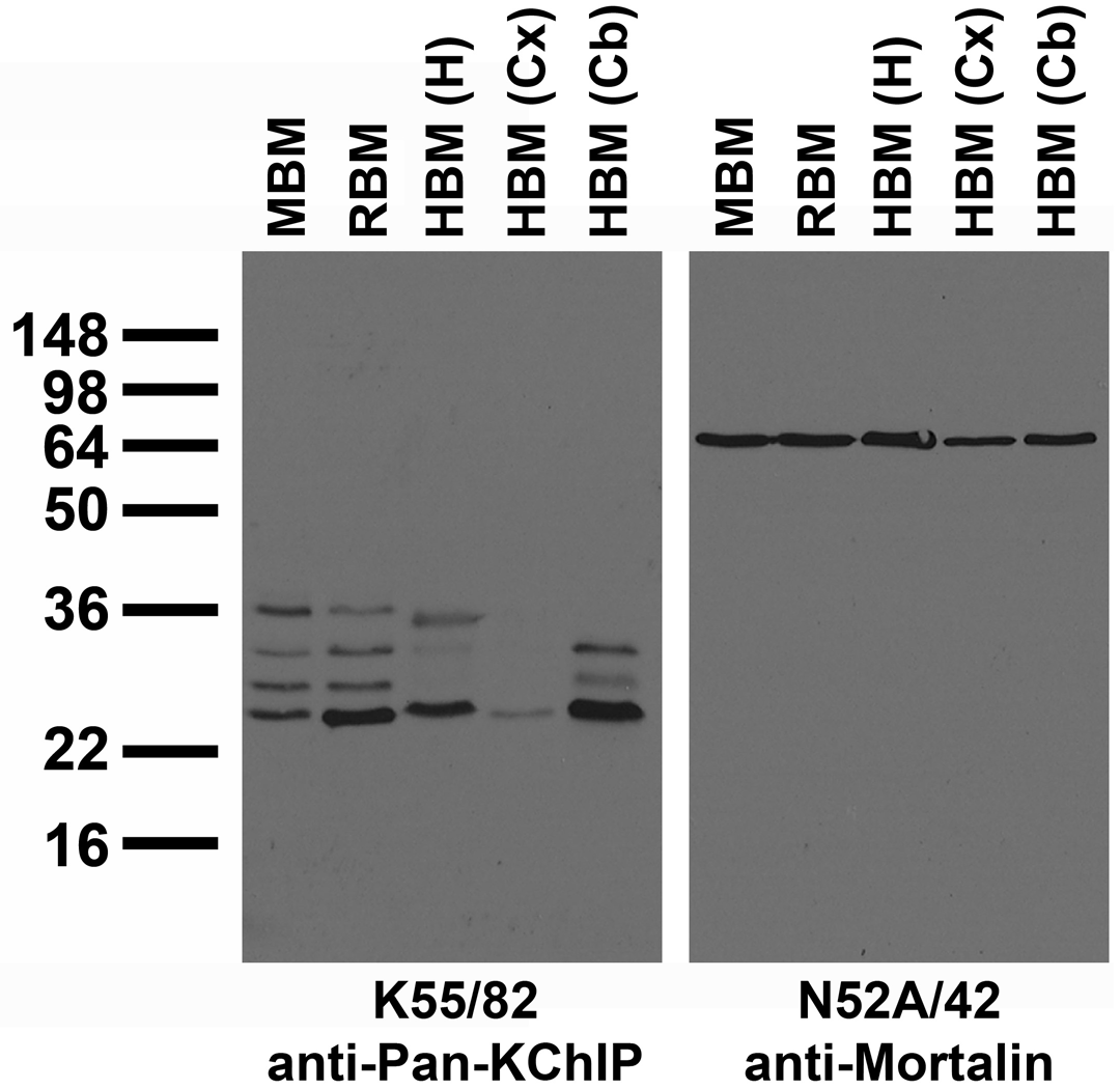 immunoblot versus crude brain membranes from adult mouse (MBM), rat (RBM) and human hippocampus [HBM(H)], cerebral cortex [HBM(Cx)] and cerebellum [HBM(Cb)] probed with K55/82 (left) and N52A/42 (right) TC supe.