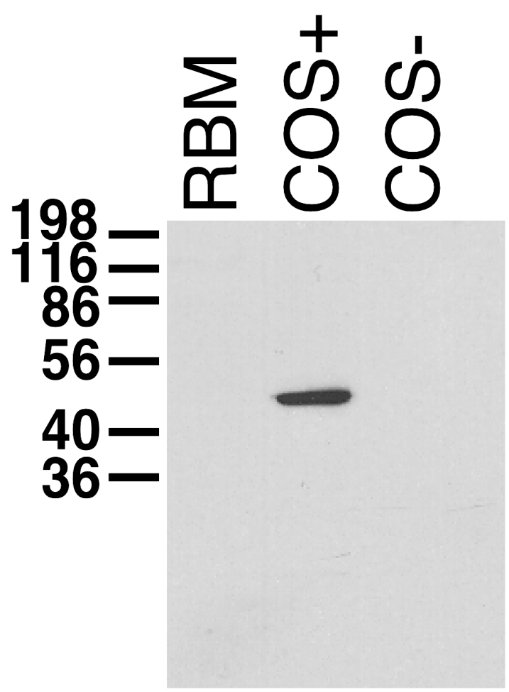 Immunoblot on adult rat brain membrane (RBM) and lysates from Kvbeta1.1 -transfected (COS+) and untransfected (COS-) COS cells