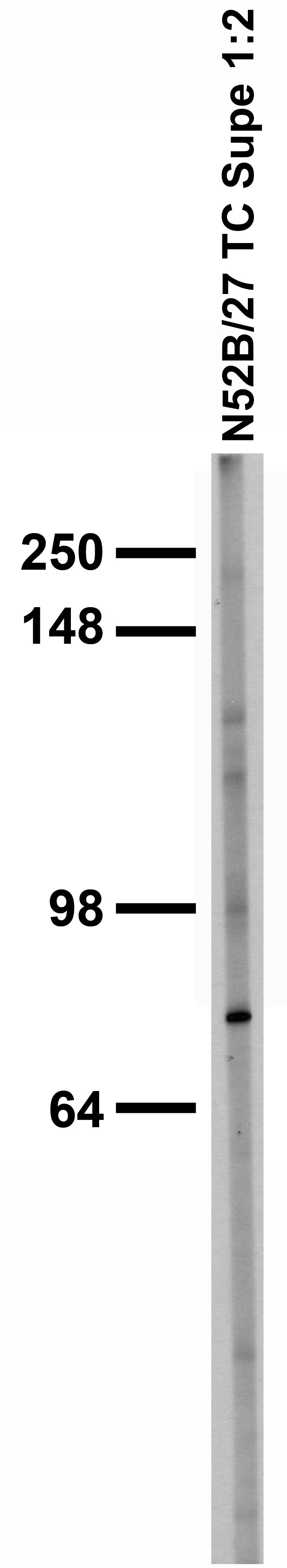 Western blot analysis in extracts from COLO205 cells using EDG-4 / LPAR2 antibody.