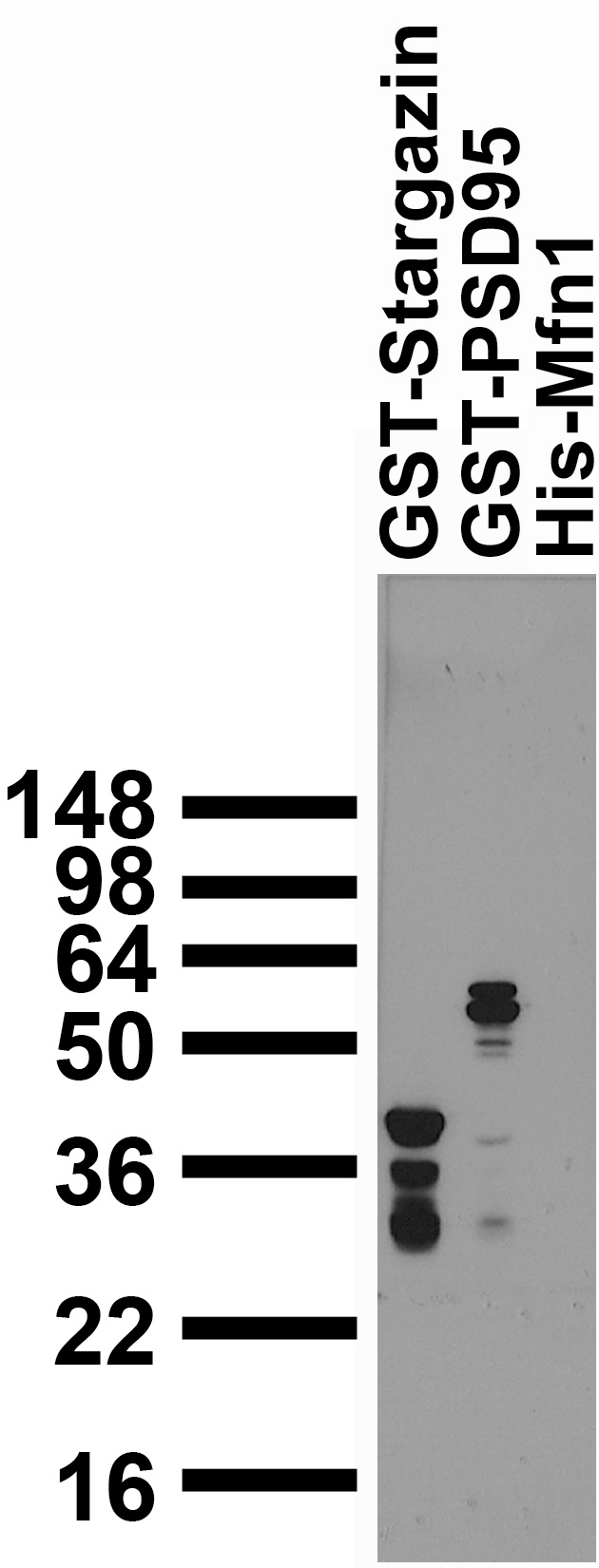 Bacterially expressed GST fusion protein immunoblot