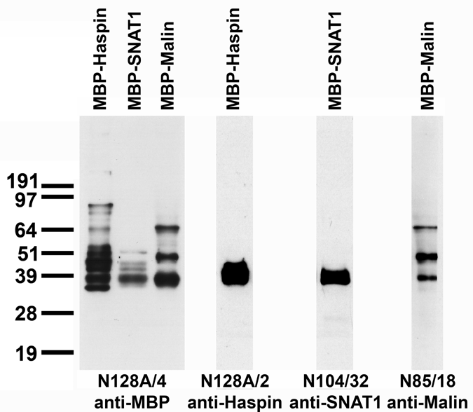 Bacterial fusion protein immunoblot