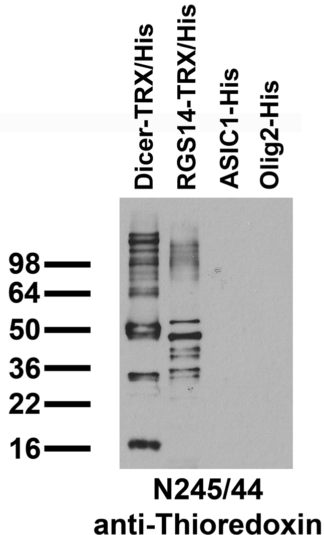 Immunoblot against bacterially expressed Thioredoxin (TRX) and/or 6xHistidine (His) tagged fusion proteins