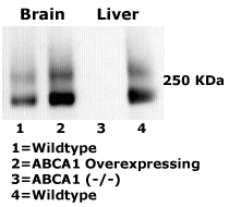 ABCA1 Mouse Monoclonal Antibody [Clone ID: HJ1]