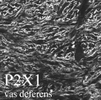 P2X1 (P2RX1) Rabbit Polyclonal Antibody