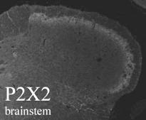 P2X2 (P2RX2) Rabbit Polyclonal Antibody
