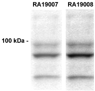 CLACP (COL25A1) (NC2-1 region) Rabbit Polyclonal Antibody