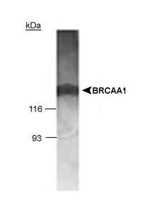 BRCAA1 antibody (ab36962) + MCF7 whole cell lysate (15 ug). Predicted Band at 136kDa.