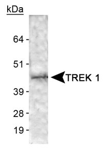 Detection of TREK 1 in human brain membrane lysate.