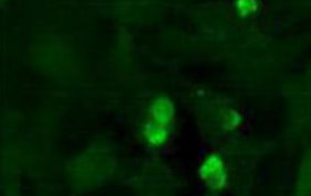 JARID2 staining of HeLa cells using a DyLight 488 conjugated secondary antibody.