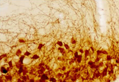 20069 Vasopressin antibody staining of Rat Brain.