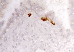 20073 Bombesin antibody staining of Rat dorsal horn.