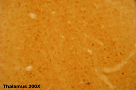 Endogenous ERP57- endoplasmic reticulum lumen marker detected at 1/500 dilution; lysates at 100ug per lane and rabbit polyclonal to goat IgG (HRP) at 1/10,000 dilution.