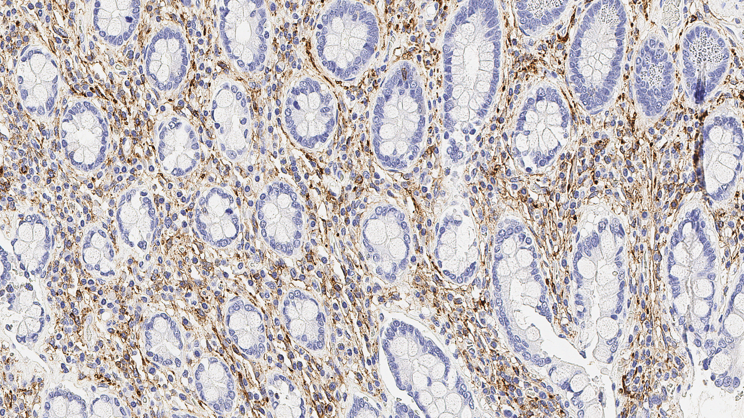 Human tonsil: immunohistochemical staining for CD56. Note the NK cells and CD4/CD8 double positive T cells show a weak to moderate and distinct membrane staining reaction while the majority of lymphocytes are unstained. CD56: clone CD564
