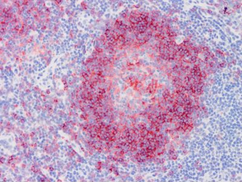 A typical staining pattern with the B-B48 monoclonal antibody of Eahy 926 cell line