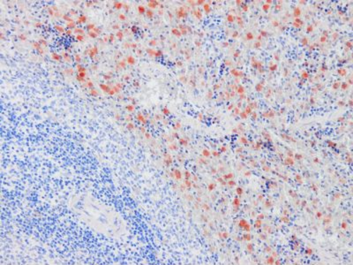 A typical staining pattern with the B-F1 monoclonal antibody of lymphocytes