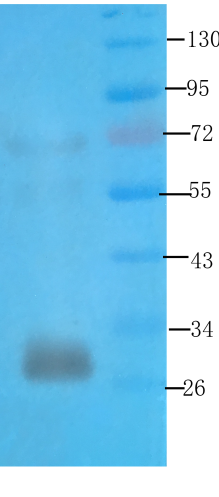Western Blot using anti-syntaxin antibody TA385875 Rat kidney lysate was resolved on a 12% SDS PAGE gel and blots probed with TA385875 at 3 microg/ml before being detected by a secondary antibody.