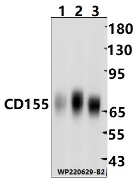 Western blot (WB) analysis of CD155 polyclonal antibody at 1:10000 dilution Lane1:CT-26 whole cell lysate(30ug) Lane2:HepG2 whole cell lysate(10ug) Lane3:A549 whole cell lysate(10ug)
