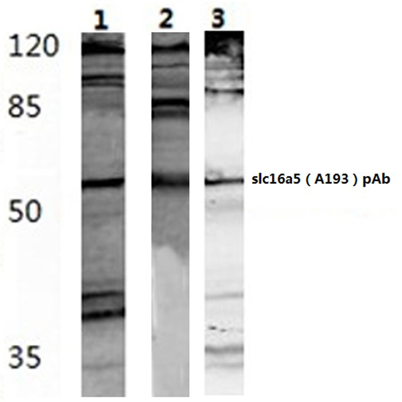 Western blot (WB) analysis of SLC16A5 (A193) polyclonal antibody at 1:500 dillution Lane1:HEK293T whole cell lysate(40microg) Lane2:NIH-3T3 whole cell lysate(40microg) Lane3:PC12 whole cell lysate(40microg)