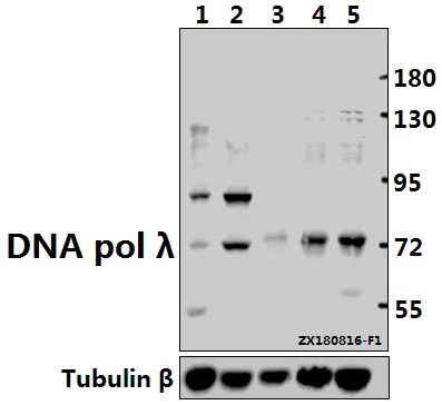 Western blot (WB) analysis of DNA pol lambda (R478) pAb at 1:500 dilution Lane1:C6 whole cell lysate(40ug) Lane2:Hela whole cell lysate(40ug) Lane3:PC3 whole cell lysate(40ug) Lane4:A549 whole cell lysate(40ug) Lane5:A2780 whole cell lysate(40ug)