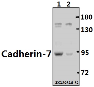 Western blot (WB) analysis of Cadherin-7 (R678) pAb at 1:500 dilution Lane1:The Brain tissue lysate of Mouse(40ug) Lane2:The Brain tissue lysate of Rat(40ug)