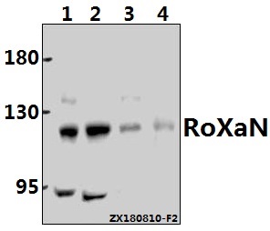 Western blot (WB) analysis of RoXaN (Q875) Antibody at 1:500 dilution Lane1:A2780 whole cell lysate(40ug) Lane2:Hela whole cell lysate(40ug) Lane3:A549 whole cell lysate(40ug) Lane4:The Lung tissue lysate of Mouse(40ug)