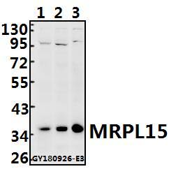 Western blot (WB) analysis of MRPL15 polyclonal antibody at 1:500 dilution Lane1:SGC7901 whole cell lysate(40ug) Lane2:HCT116 whole cell lysate(40ug) Lane3:HEK293T whole cell lysate(40ug)