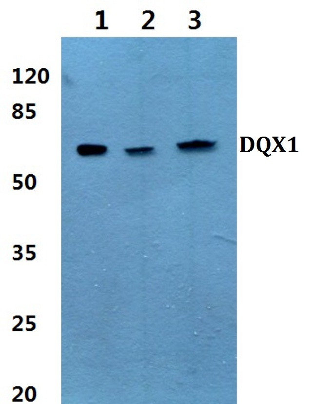 Western blot (WB) analysis of DQX1 (L595) pAb at 1:500 dilution Lane1:HepG2 whole cell lysate(40ug) Lane2:HCT116 whole cell lysate(40ug) Lane3:SGC7901 whole cell lysate(40ug) Lane4:CT26 whole cell lysate(40ug) Lane5:H9C2 whole cell lysate(40ug)