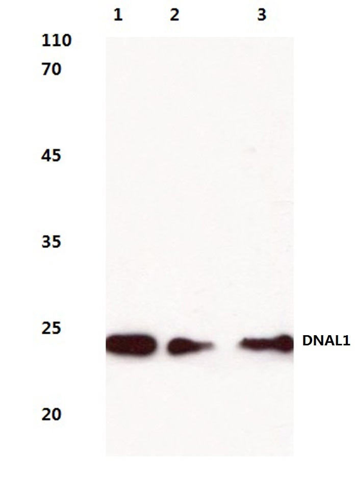 Western blot (WB) analysis of DNAL1 (N161) pAb at 1:1000 dilution Lane1:L02 whole cell lysate(20ug) Lane2:HepG2 whole cell lysate(40ug) Lane3:AML-12 whole cell lysate(40ug) Lane4:C6 whole cell lysate(40ug)