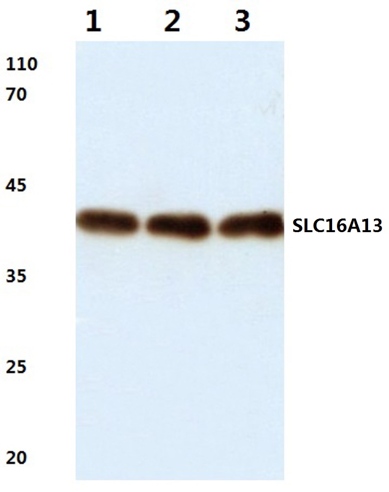 Western blot (WB) analysis of SLC16A13 (L423) pAb at 1:500 dilution Lane1:C6 whole cell lysate(40ug) Lane2:3T3-L1 whole cell lysate(40ug) Lane3:MCF-7 whole cell lysate(40ug) Lane4:HepG2 whole cell lysate(40ug) Lane5:H1792 whole cell lysate(20ug)