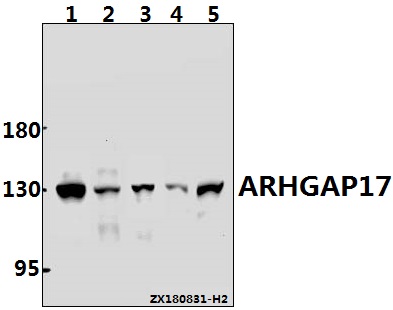 Western blot (WB) analysis of ARHGAP17 (T363) pAb at 1:1000 dilution Lane1:Hela whole cell lysate(30ug) Lane2:HCT116 whole cell lysate(40ug) Lane3:A375 whole cell lysate(40ug) Lane4:The Embryo tissue lysate of Mouse(40ug) Lane5:H9C2 whole cell lysate(40ug)