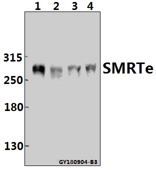 Western blot (WB) analysis of SMRTe (K535) Antibody at 1:500 dilution Lane1:A549 whole cell lysate(40ug) Lane2:Hela whole cell lysate(40ug) Lane3:3T3-L1 whole cell lysate(40ug) Lane4:C6 whole cell lysate(40ug)