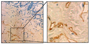 Immunohistochemical detection of Human Aggrus/Podoplanin on paraffin embedded section of Human normal rectum with AM26512SU-N. Immunohistochemical detection of Human Aggrus/Podoplanin on paraffin embedded section of Human normal rectum with AM26512SU-N.